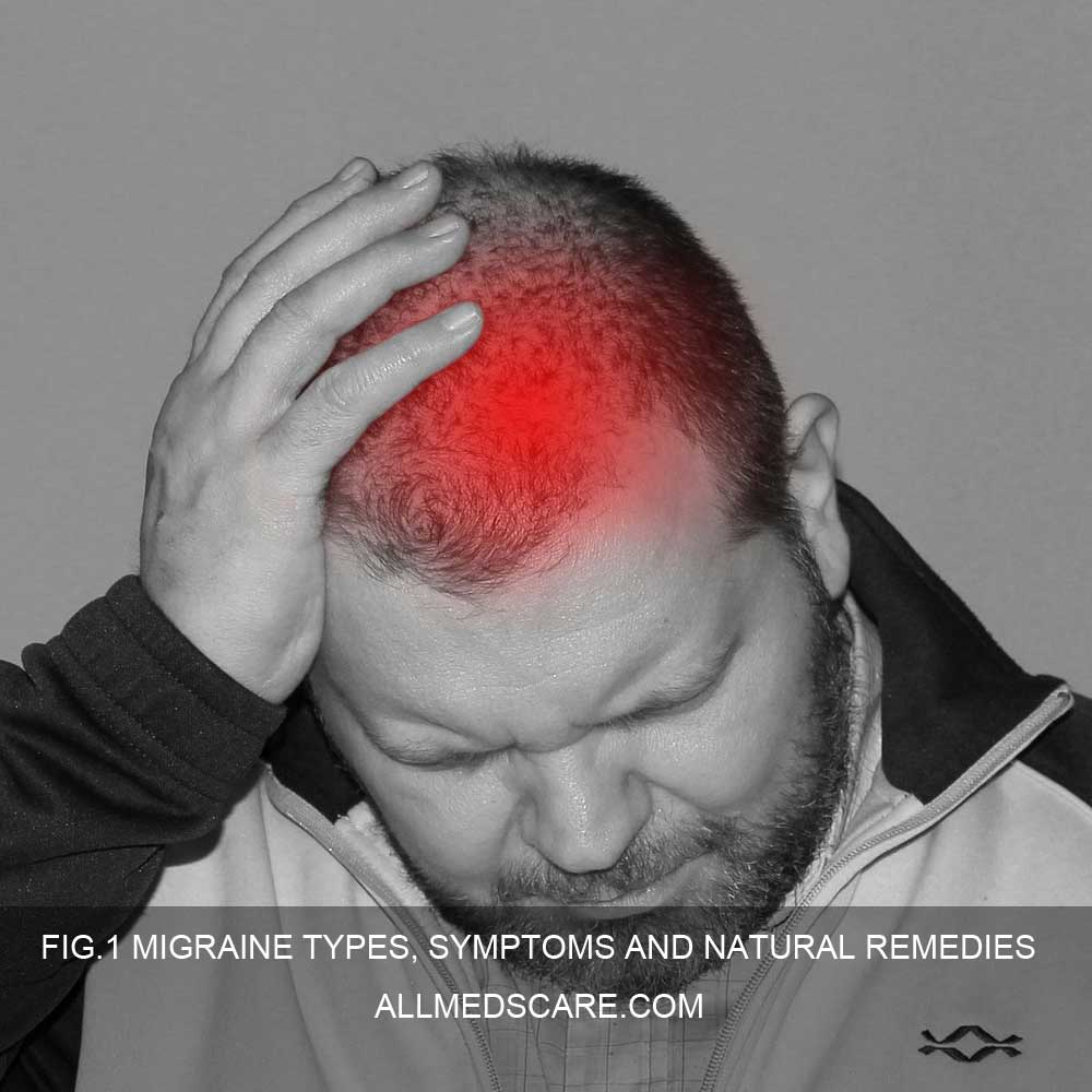 Migraine Remedies- Natural ways & Information-Allmedscare.com